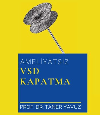 Ameliyatsız VSD Kapatma