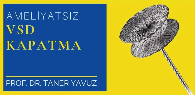 Ameliyatsız VSD Kapatma