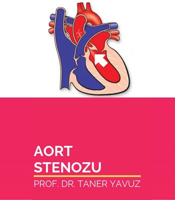 Aort Stenozu (Aort Kapak Darlığı)