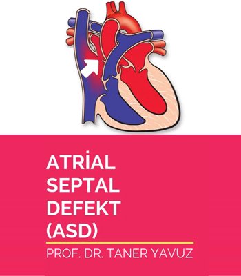 Atrial Septal Defekt (ASD)