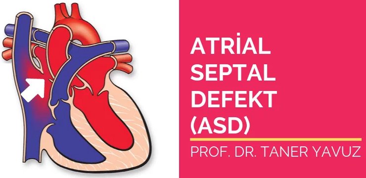 Atrial Septal Defekt (ASD)