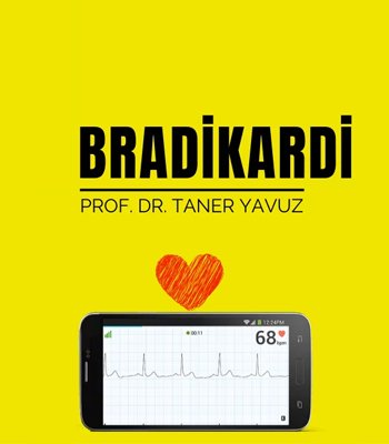 Bradikardi
