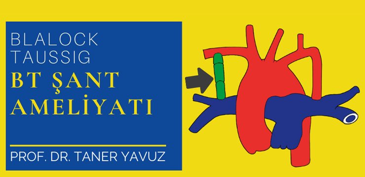 BT Şant (Blalock Taussig) Ameliyatı