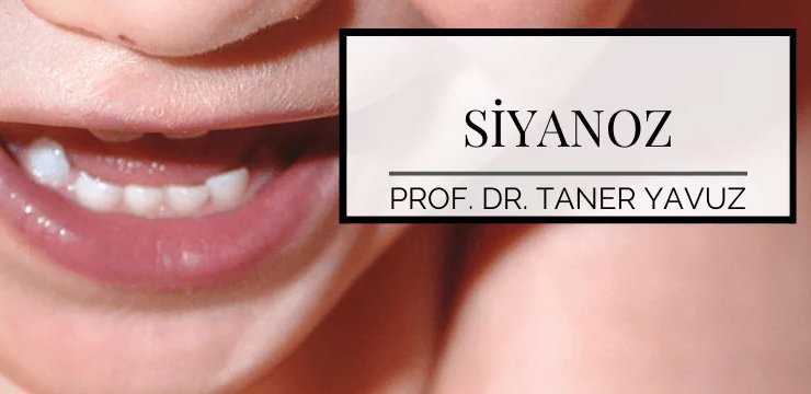 Çocuklarda Siyanoz (Morarma) Neden Olur?