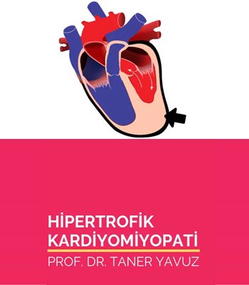 Hipertrofik Kardiyomiyopati (HKMP)