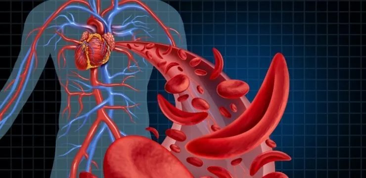 Kalp Damar Tıkanıklığı