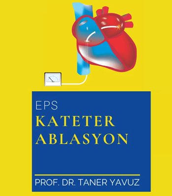 Kateter Ablasyon