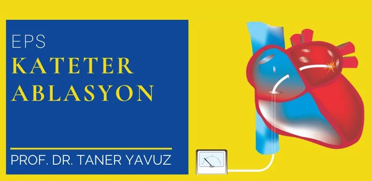 Kateter Ablasyon