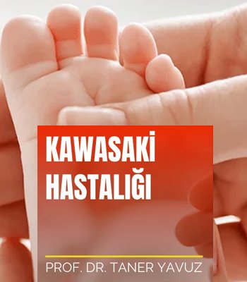 Kawasaki Hastalığı