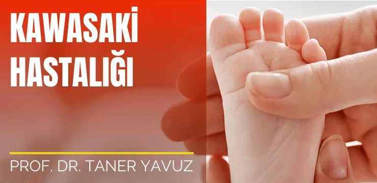 Kawasaki Hastalığı