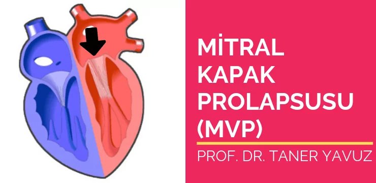 Mitral Kapak Prolapsusu (MVP)