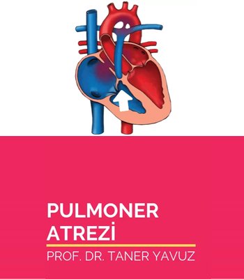Pulmoner Atrezi