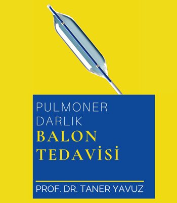Pulmoner Balon Tedavisi