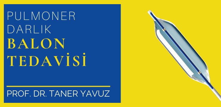 Pulmoner Balon Tedavisi