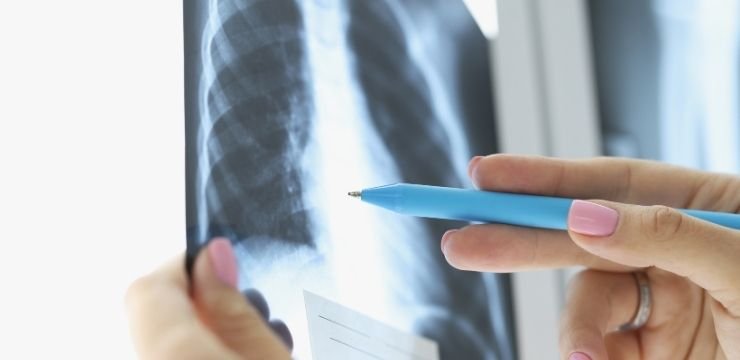Pulmoner Darlık