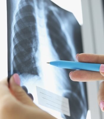 Pulmoner Darlık