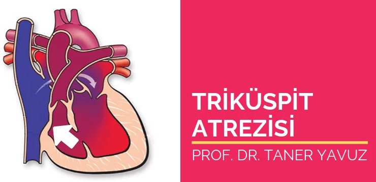 Triküspit Atrezisi