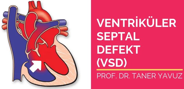 Ventriküler Septal Defekt (VSD)