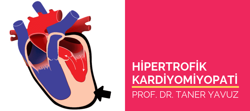 Hipertrofik kardiyomiyopati HKMP